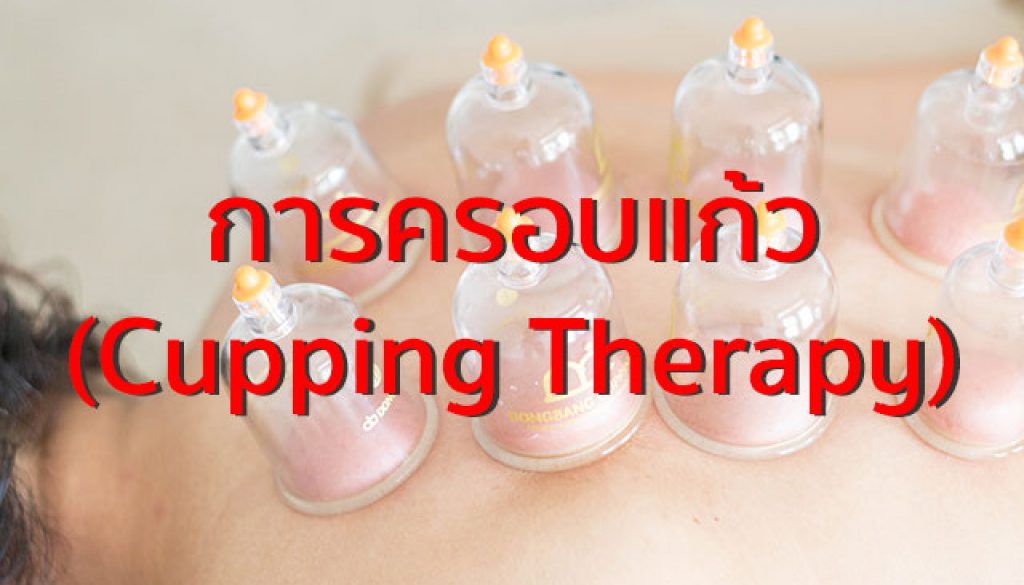 การครอบแก้ว
