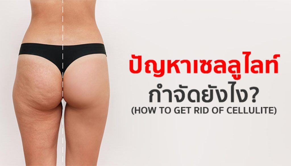 ปัญหาเซลลูไลท์กำจัดยังไง-เซลลูไลท์ที่ต้นขา